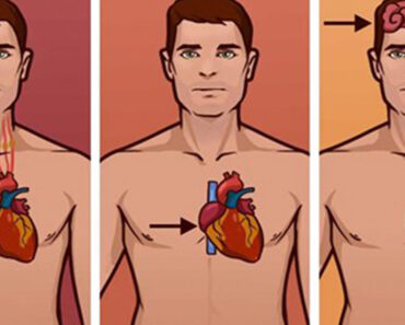 Know the difference between a heart attack, a cardiac arrest and a stroke. It could save a life