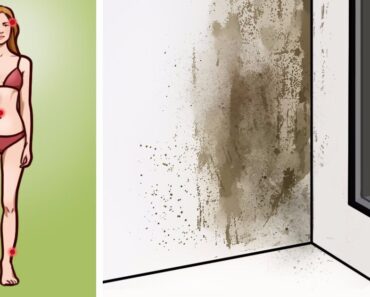 Don’t take a risk. 10 signs of mold illness